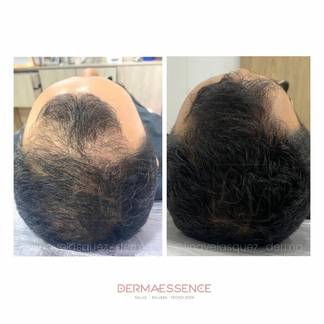 Lina Velásquez Tafur-6