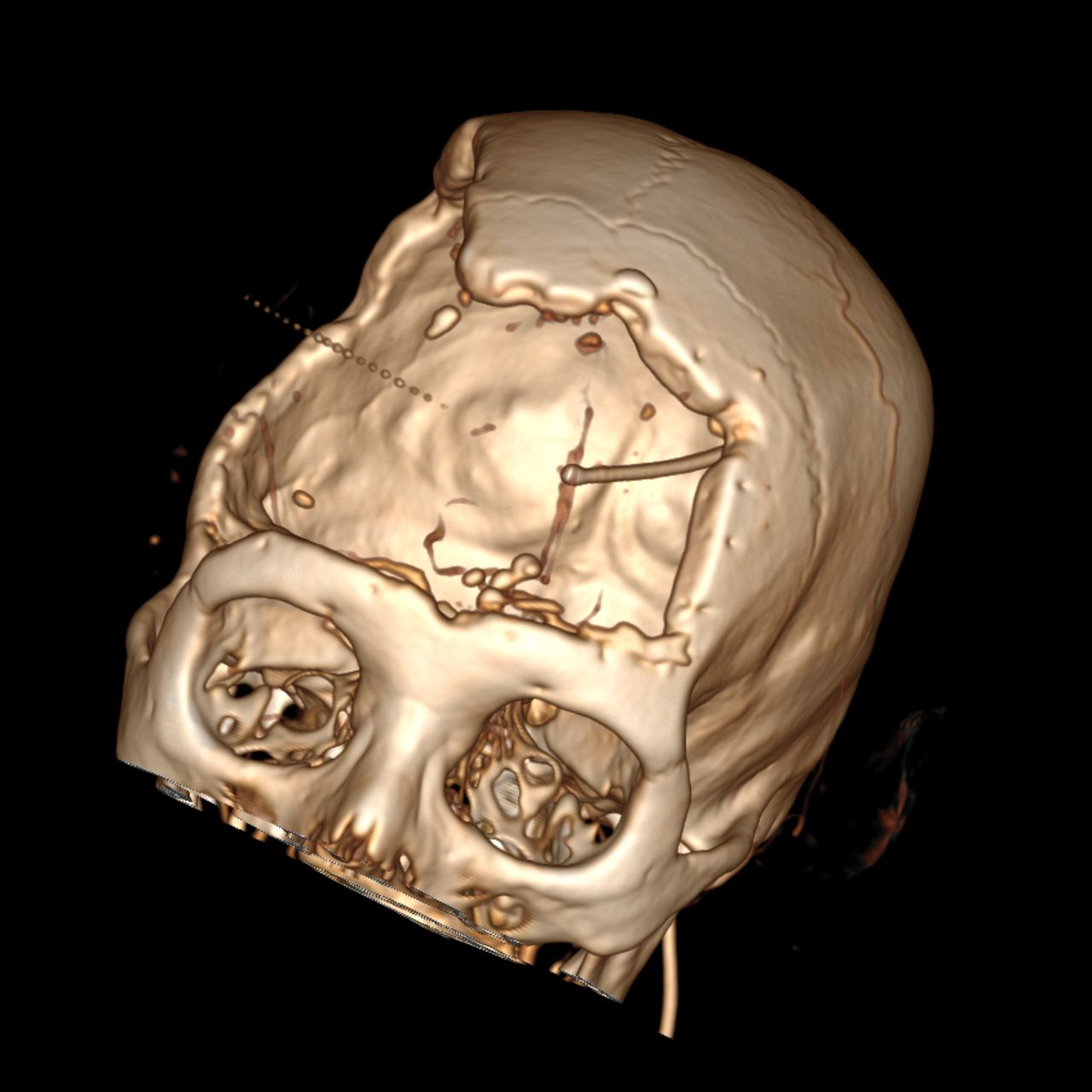 David Tafur Muñoz-1264