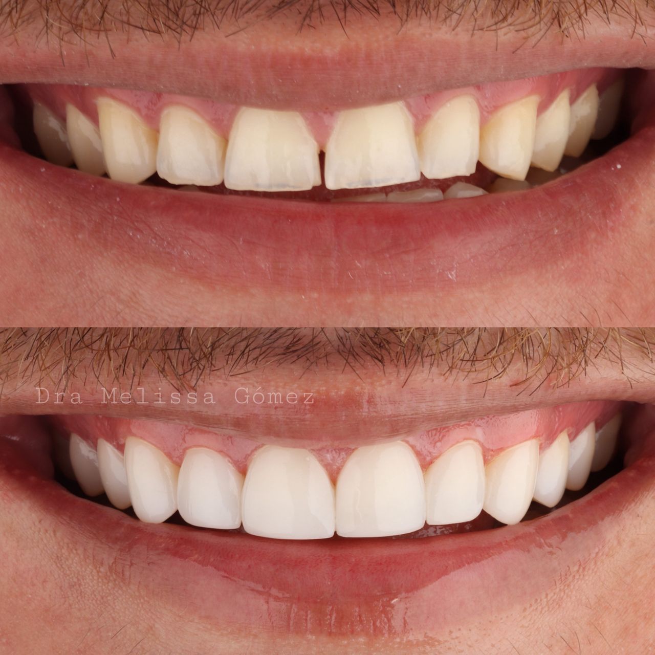 Melissa Gómez Arango-13