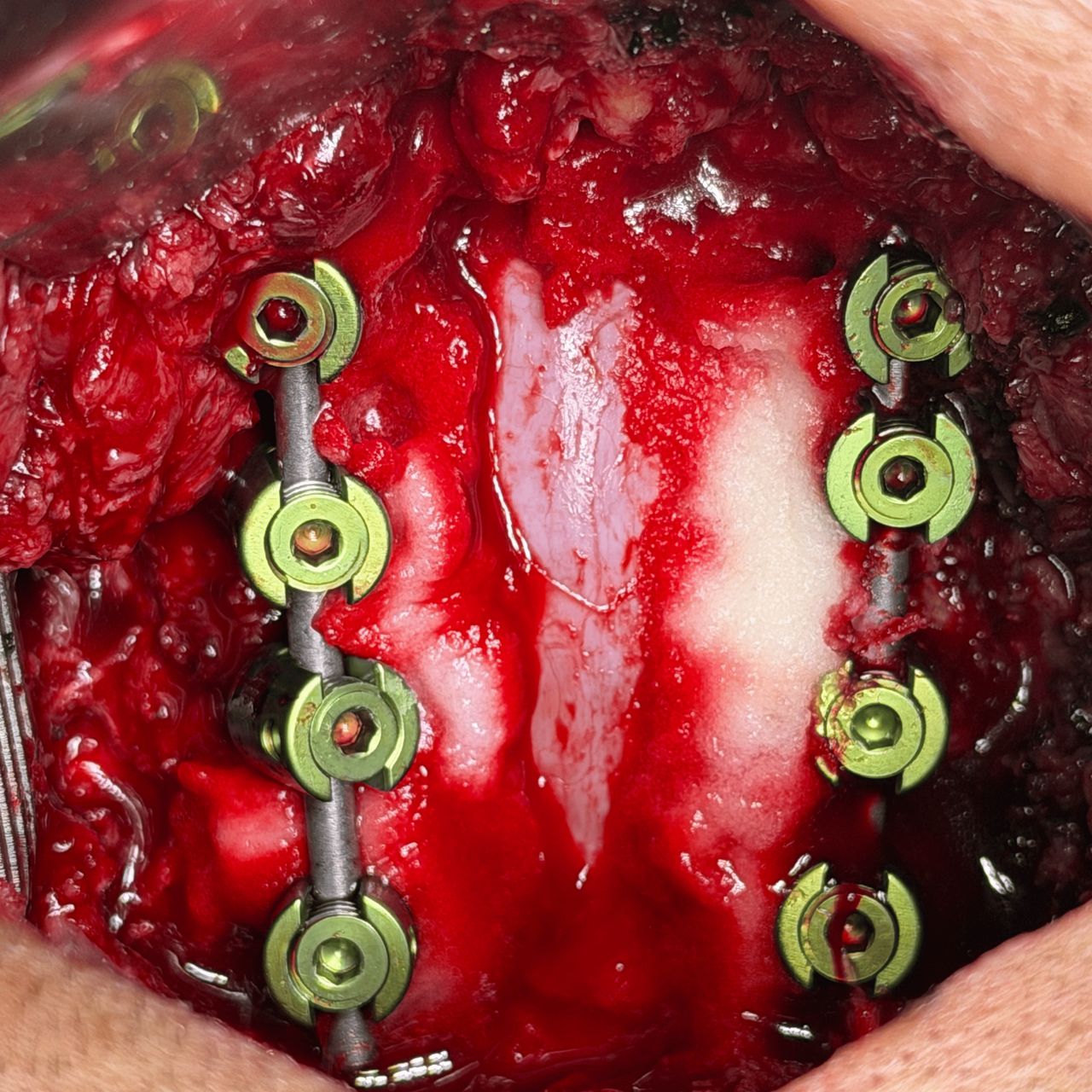 David Tafur Muñoz-2340