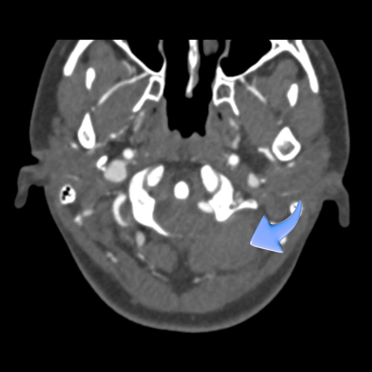 David Tafur Muñoz-2126