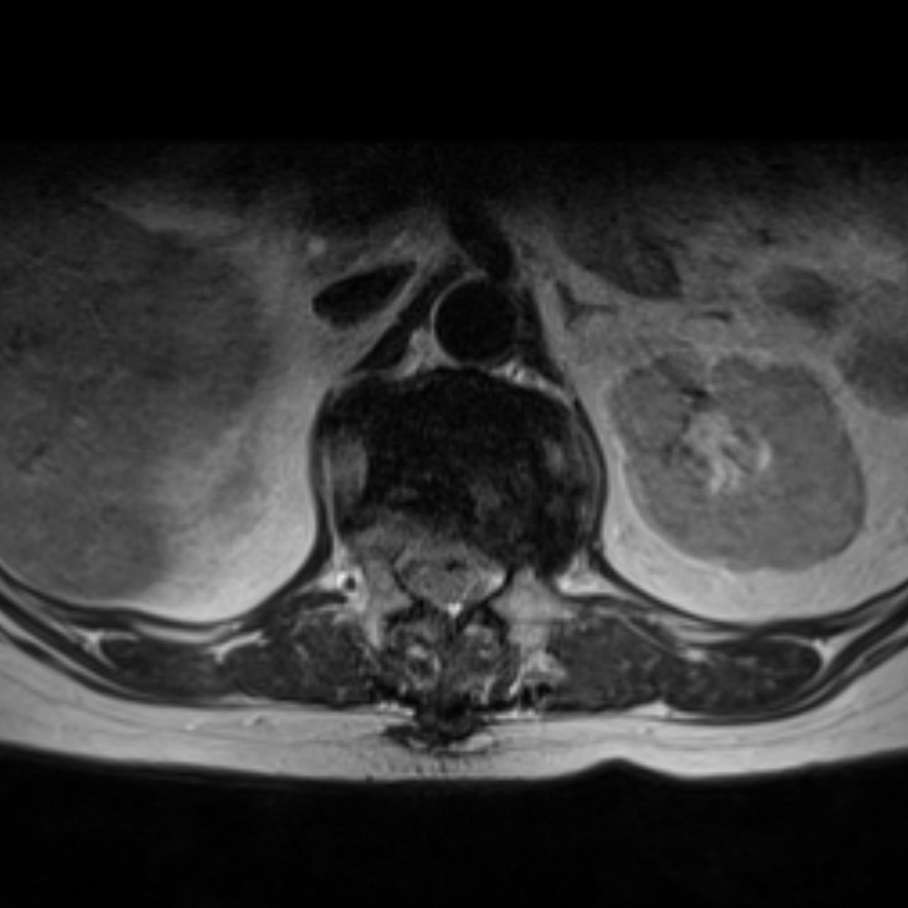 David Tafur Muñoz-1961