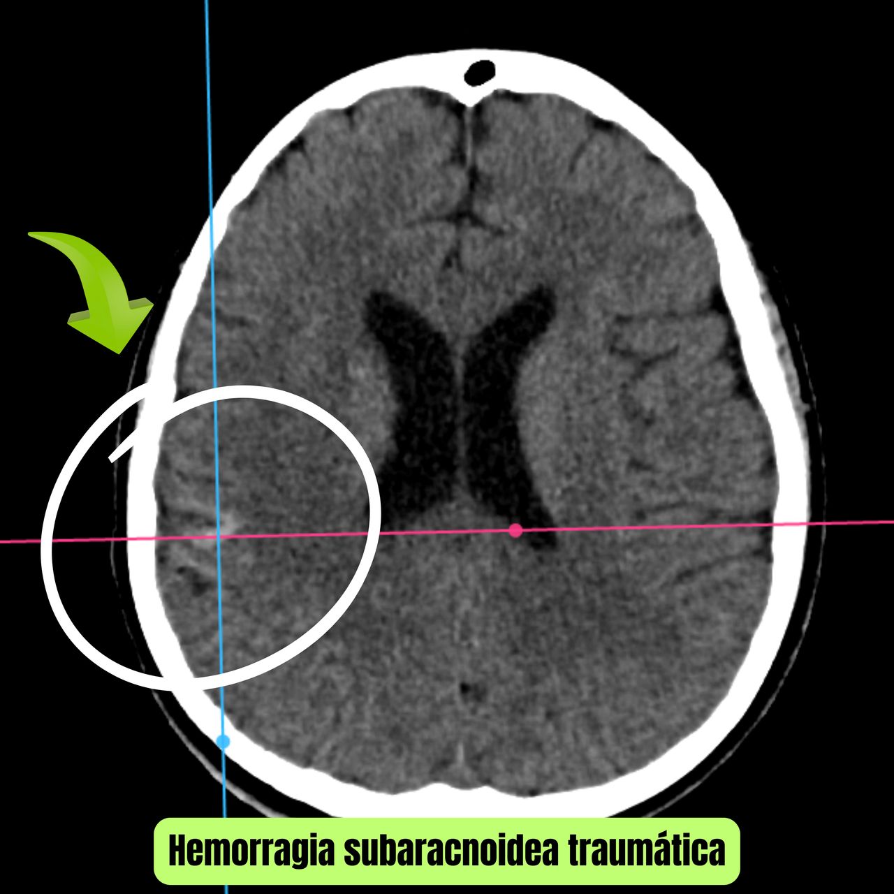 David Tafur Muñoz-1053