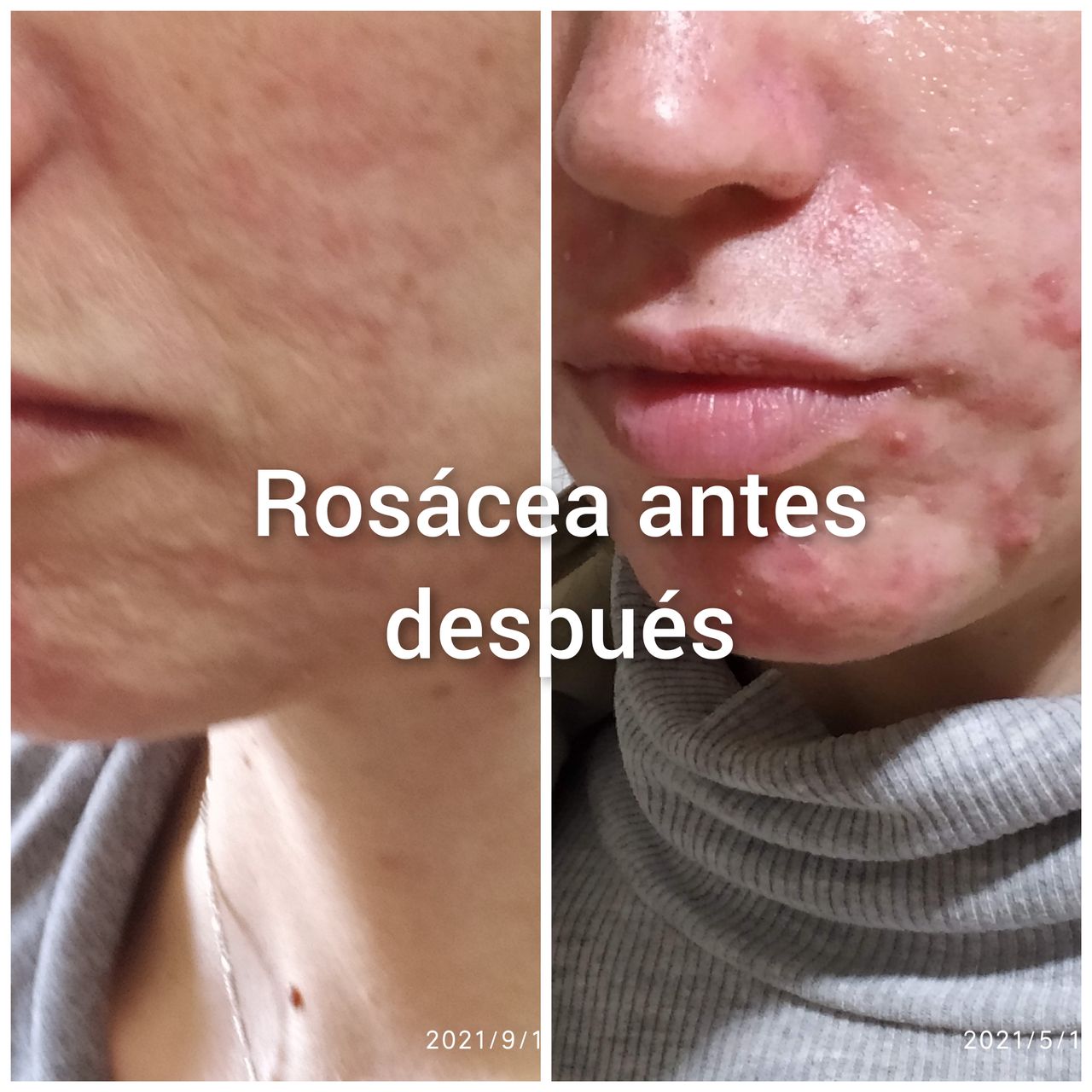 Alejandra Meijide-24