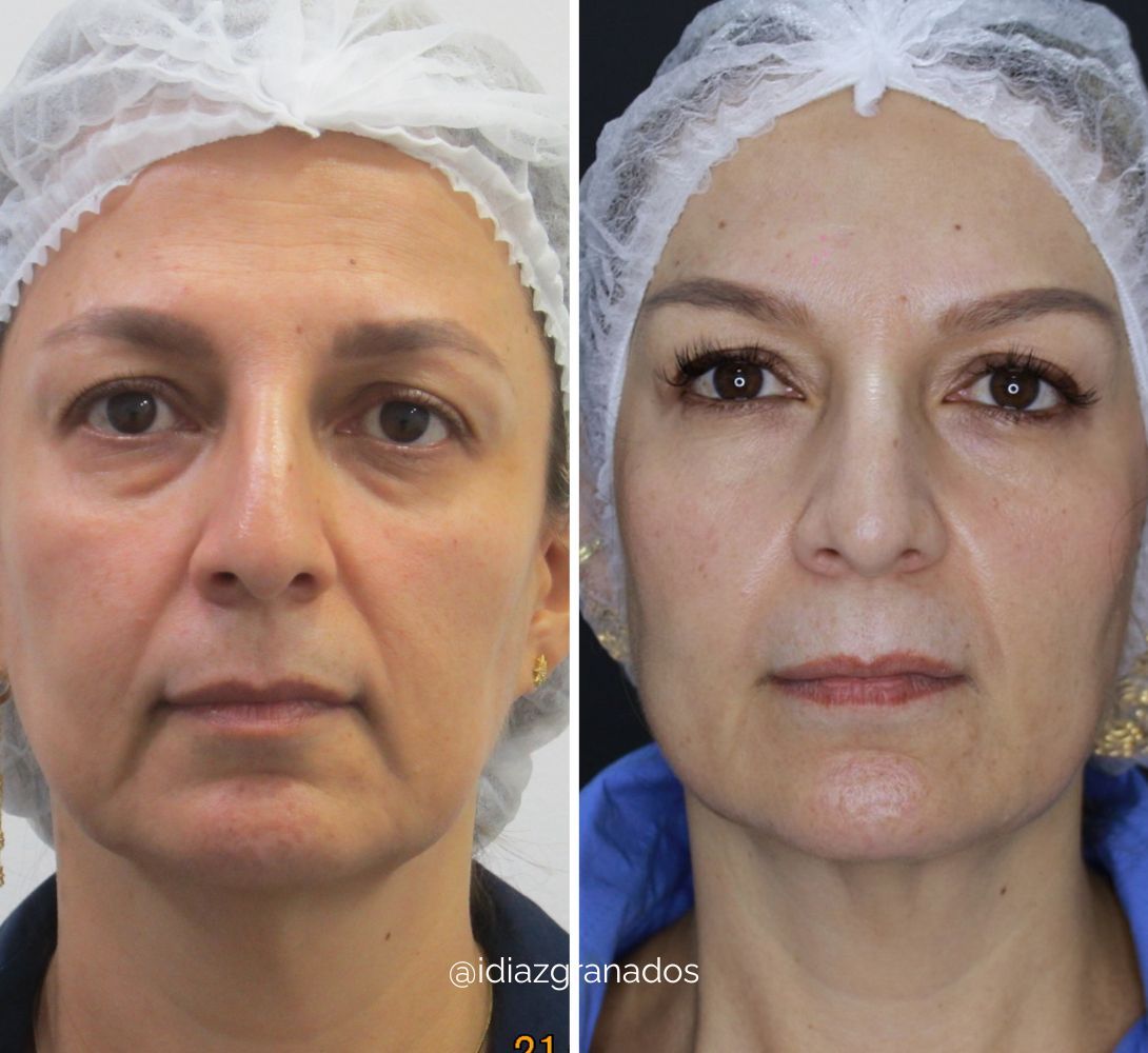 Ivan Diazgranados Fernandez-5