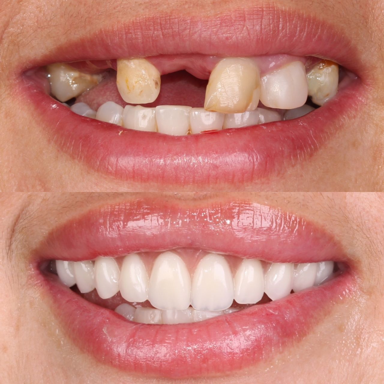 Caroline Benedeti-29