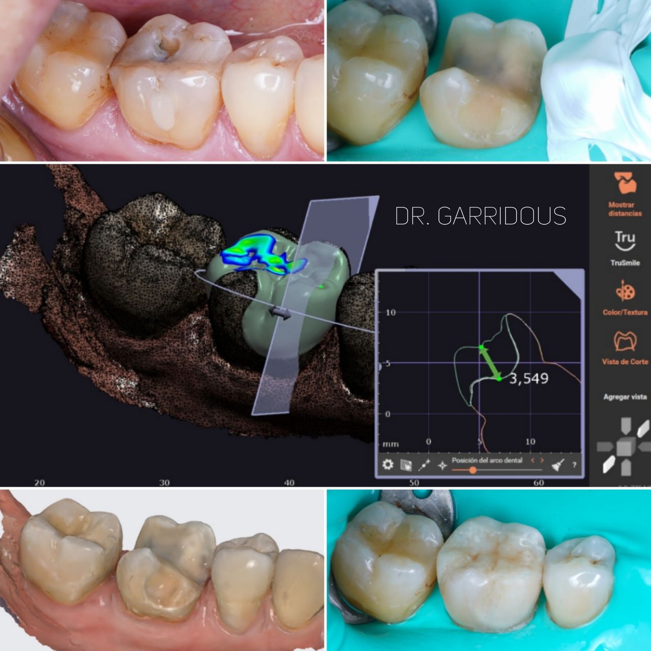 Javier Garrido Tirado-7