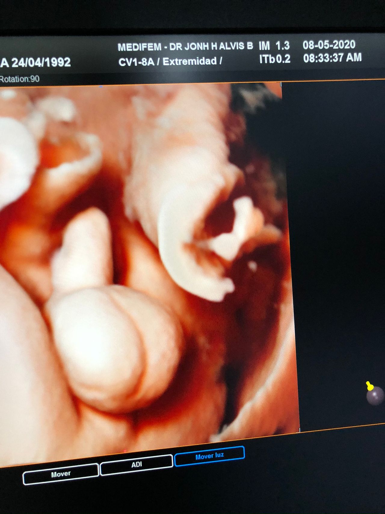 Jonh Harold Alvis Botello-22