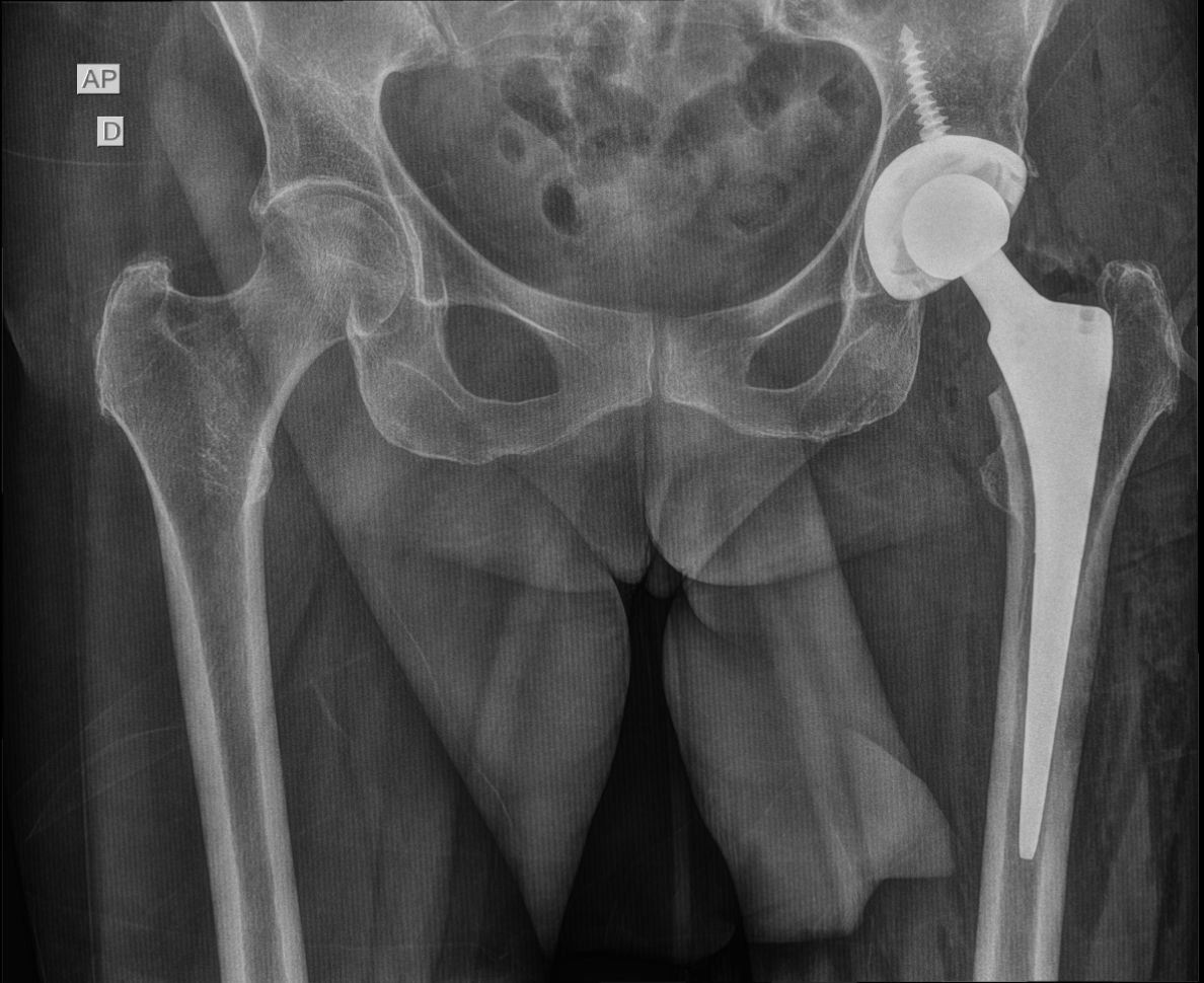 João Mauro Mendina De Morais-6
