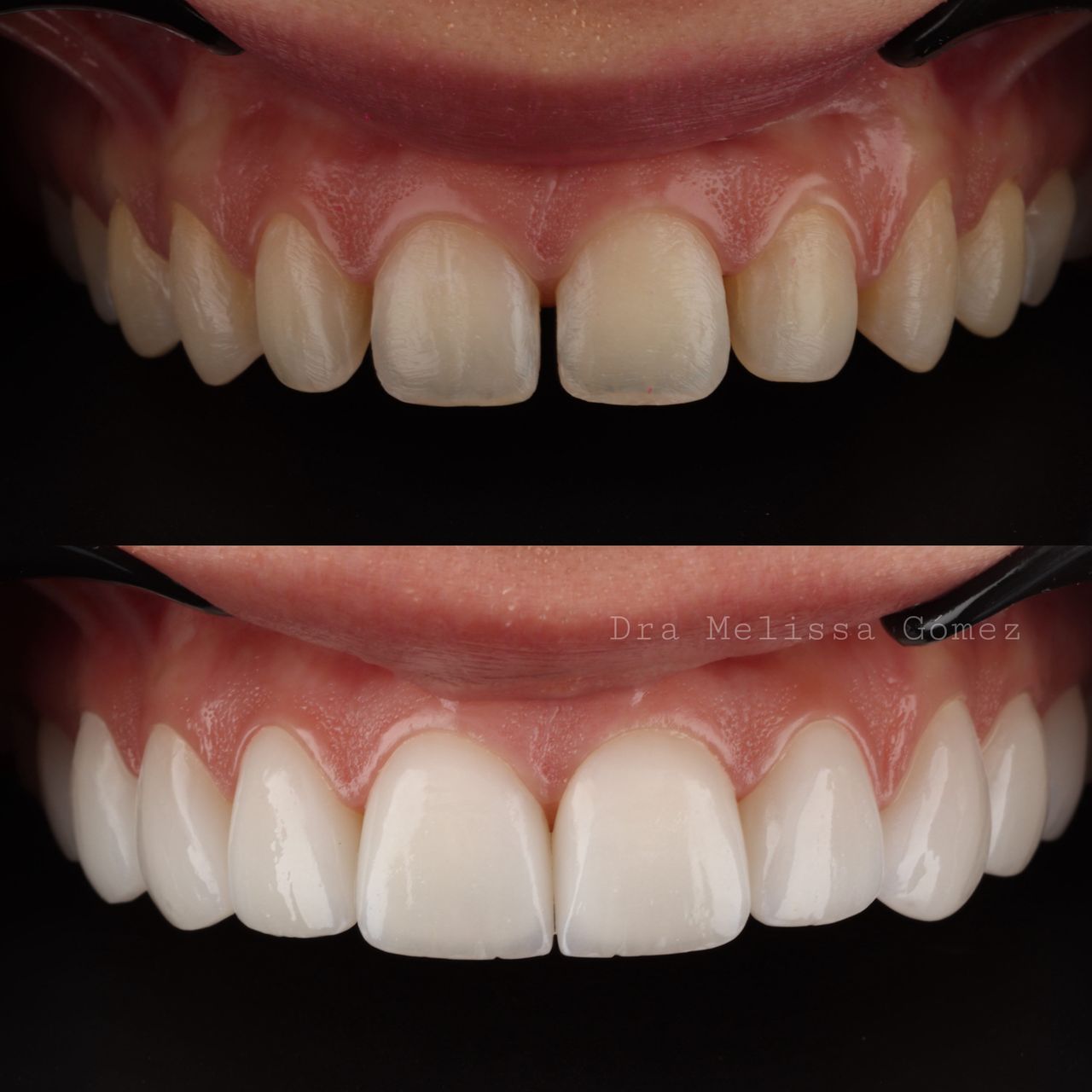 Melissa Gómez Arango-21