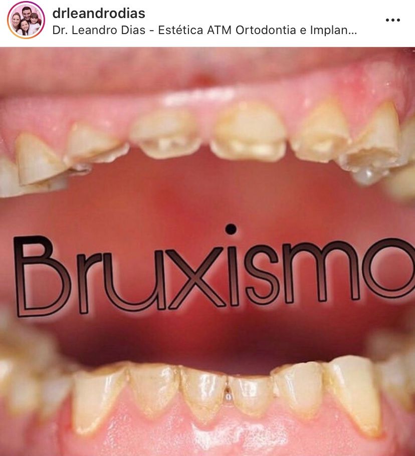 Leandro Ponte Dias-28