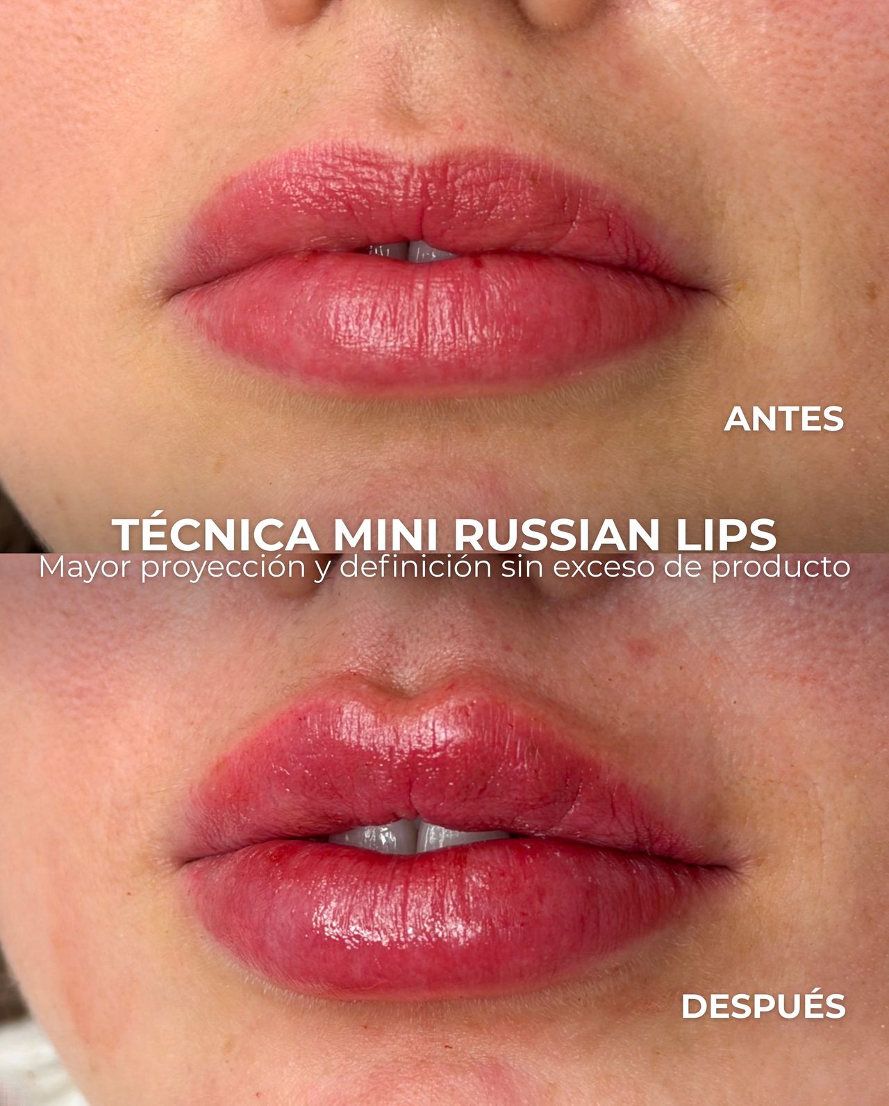 Edwin Cáceres Melendez-1