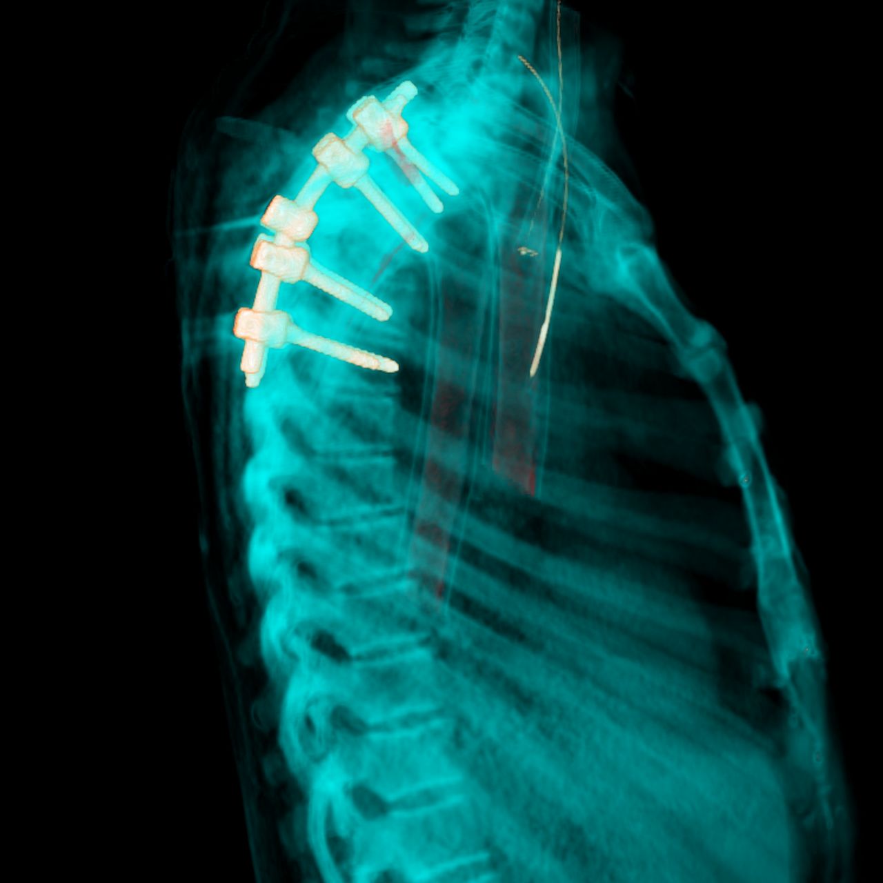 David Tafur Muñoz-1501