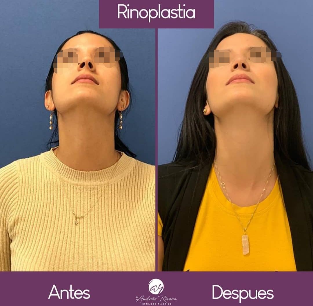 Andrés Rivera López-59