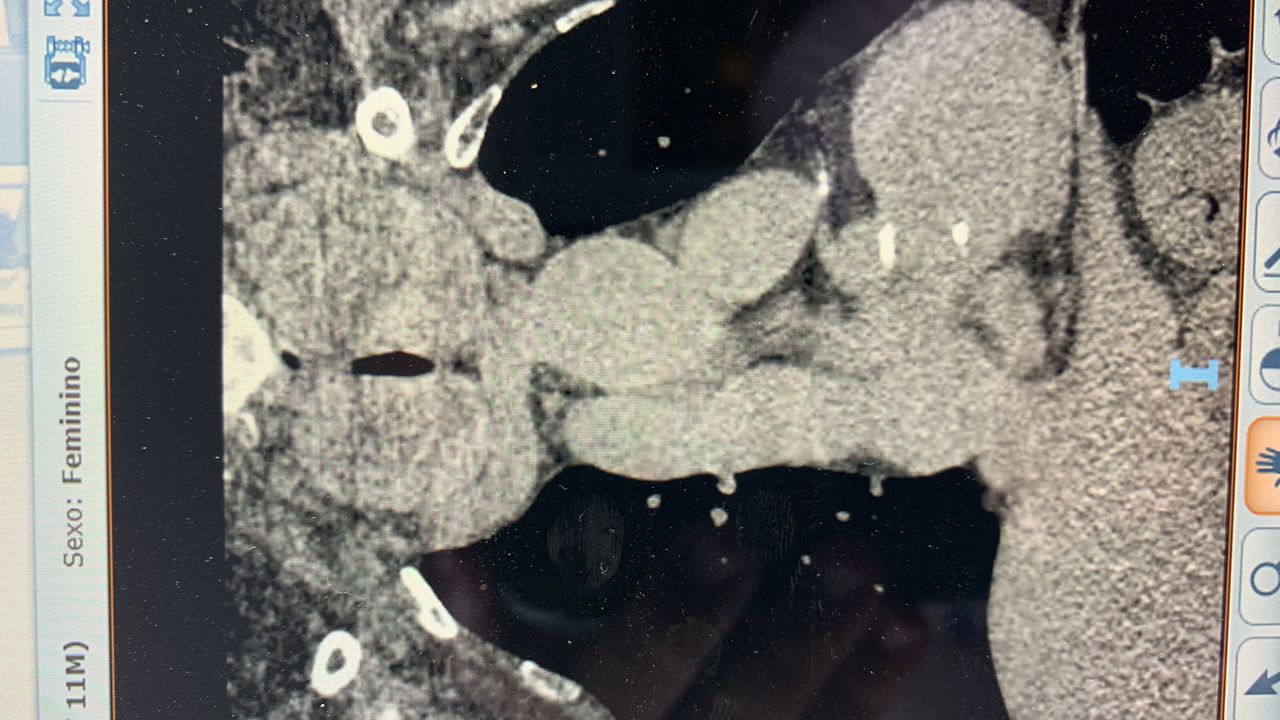 Giulianno Molina De Melo-11