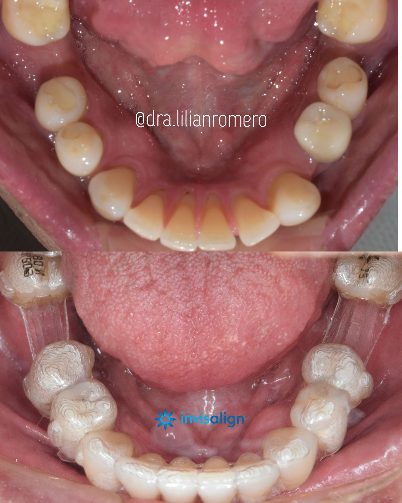 Lilian Catalina Romero Diaz-12