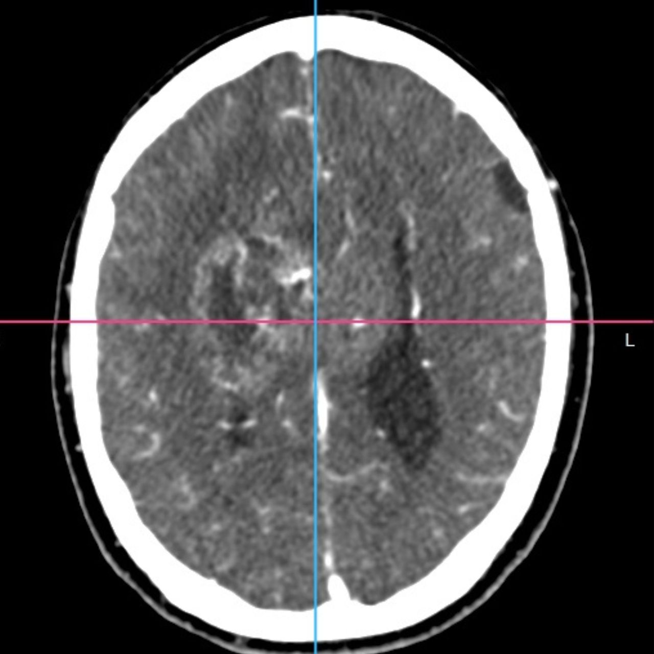 David Tafur Muñoz-1622