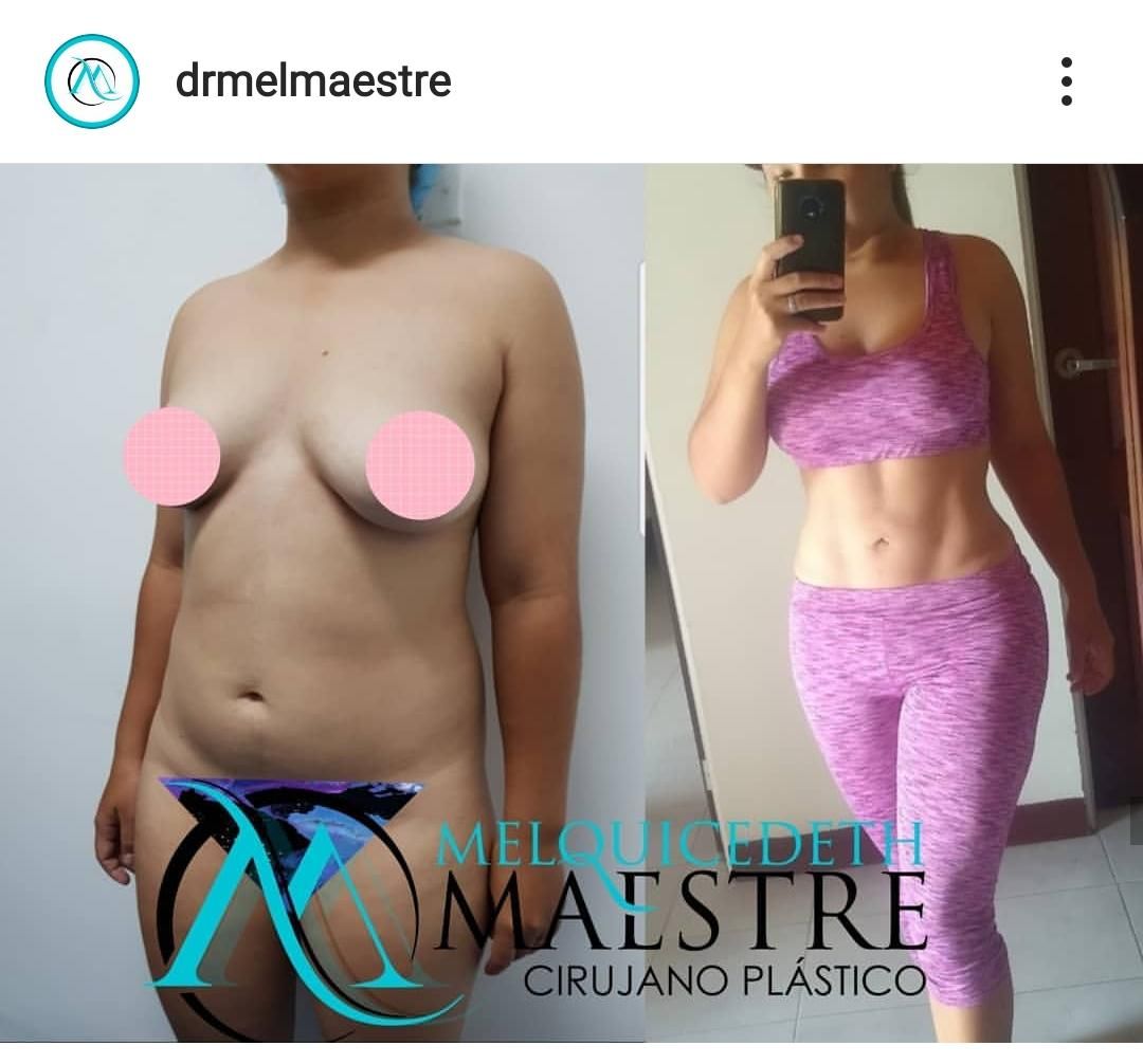 Melquicedeth Maestre-11