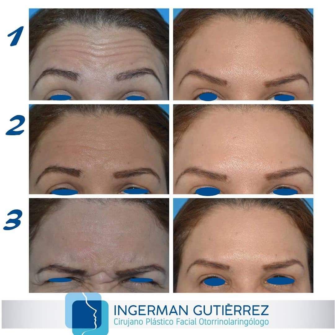 Ingerman Gutiérrez González-17