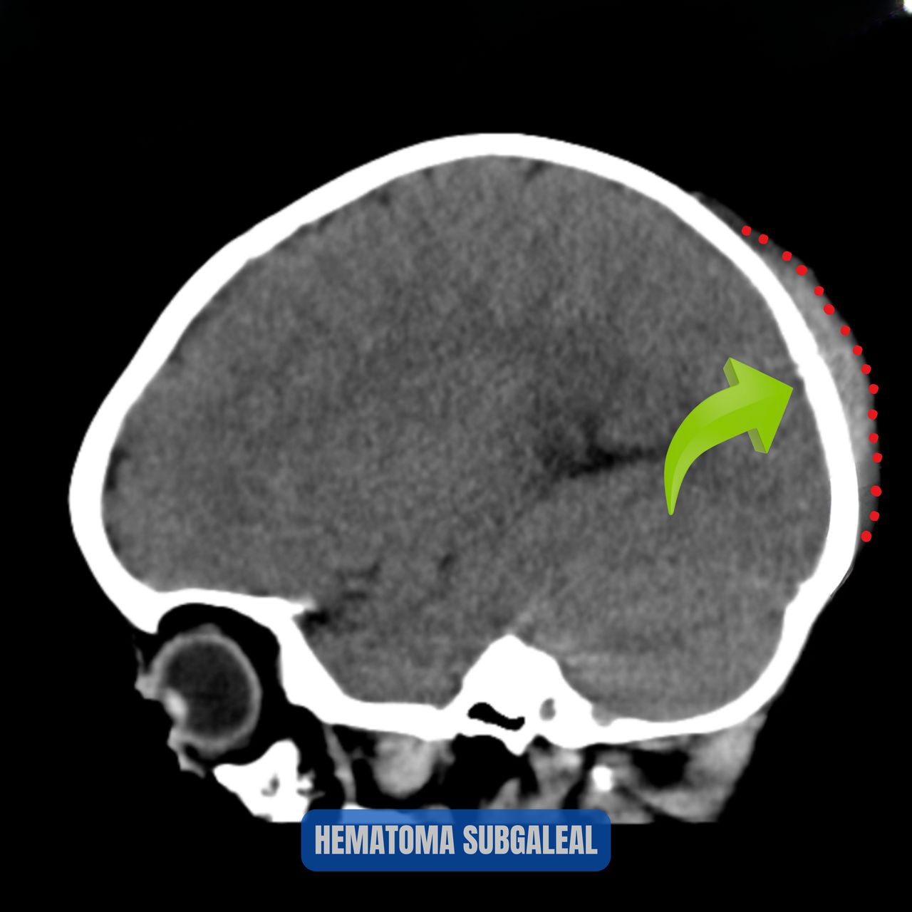 David Tafur Muñoz-2042