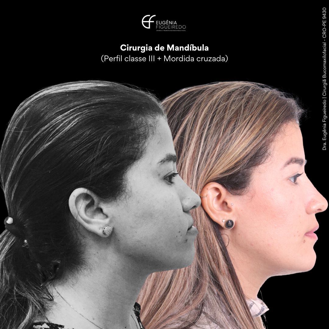 Eugênia Figueiredo-40