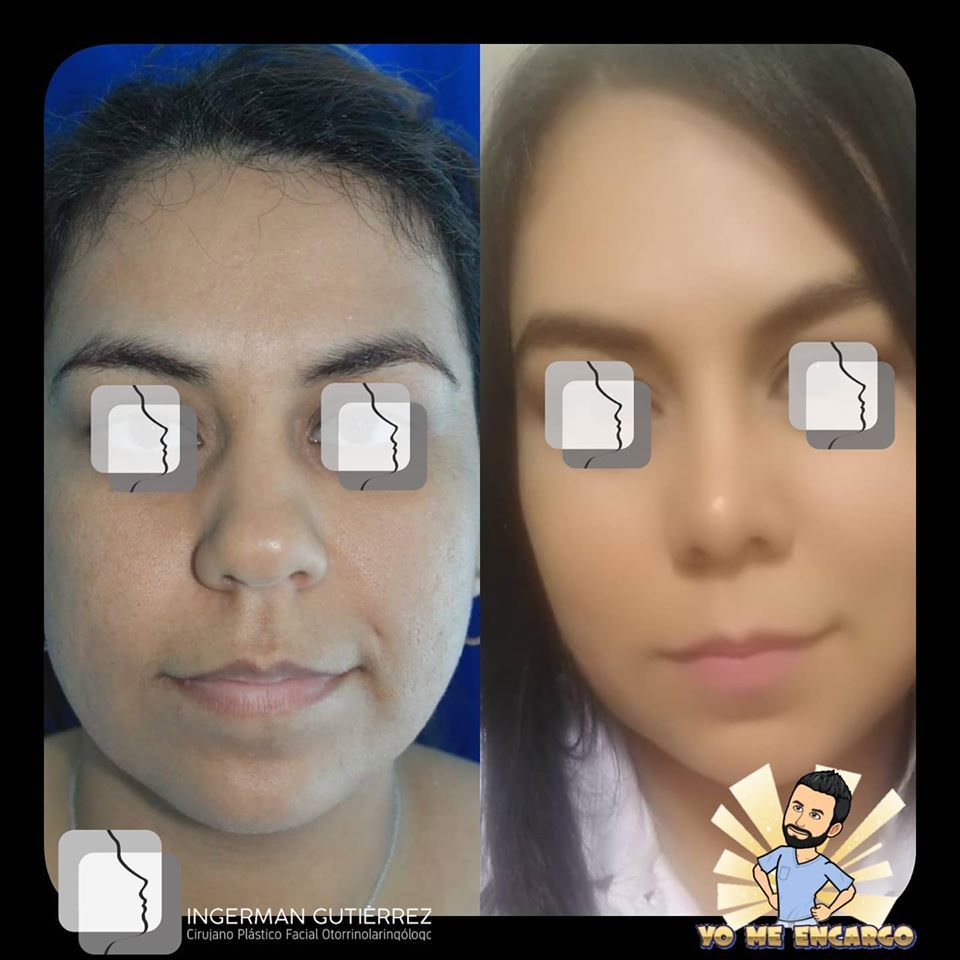 Ingerman Gutiérrez González-7