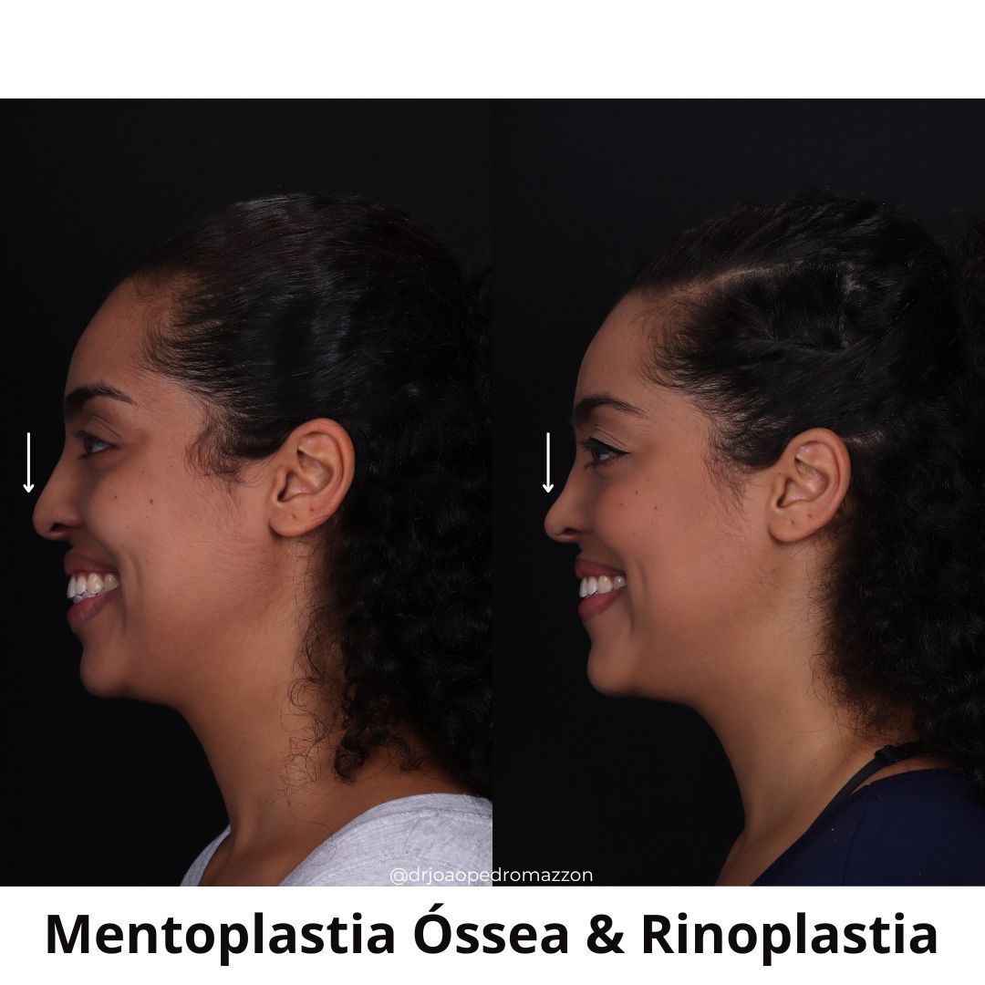 João Pedro Paulino Mazzon-20