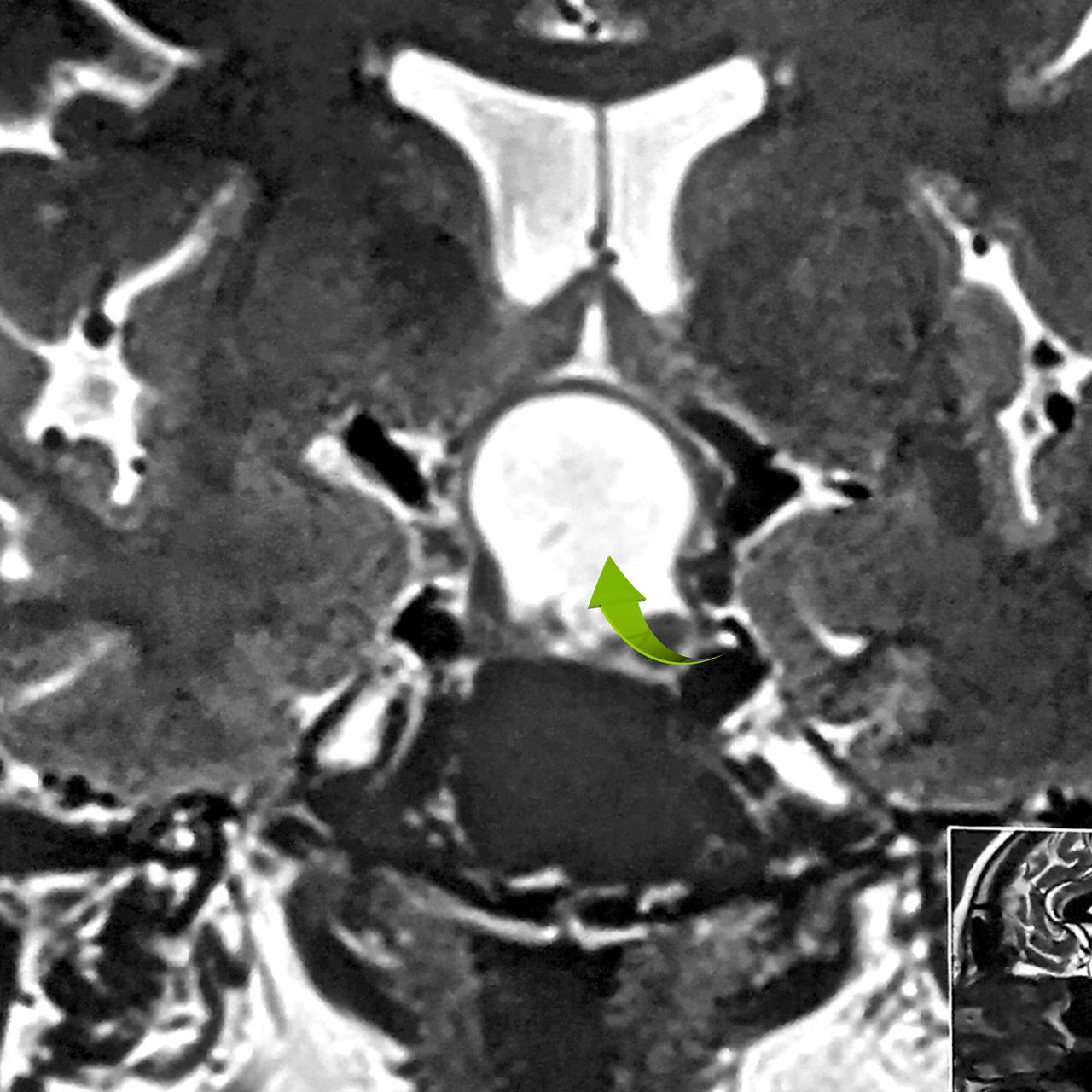 David Tafur Muñoz-1232