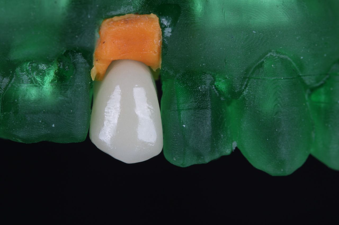 Gabriel Lucio Calazans Duarte-2