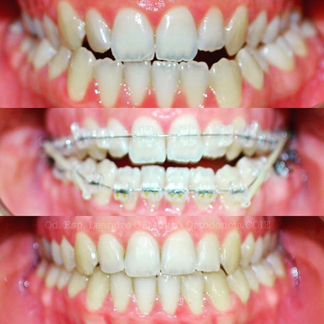 Leandro G. Milito-14