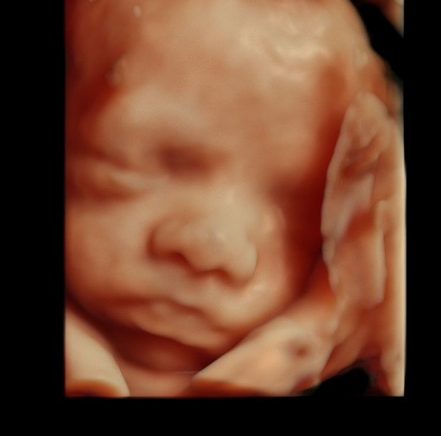 Charles Schwantz De Lima-25