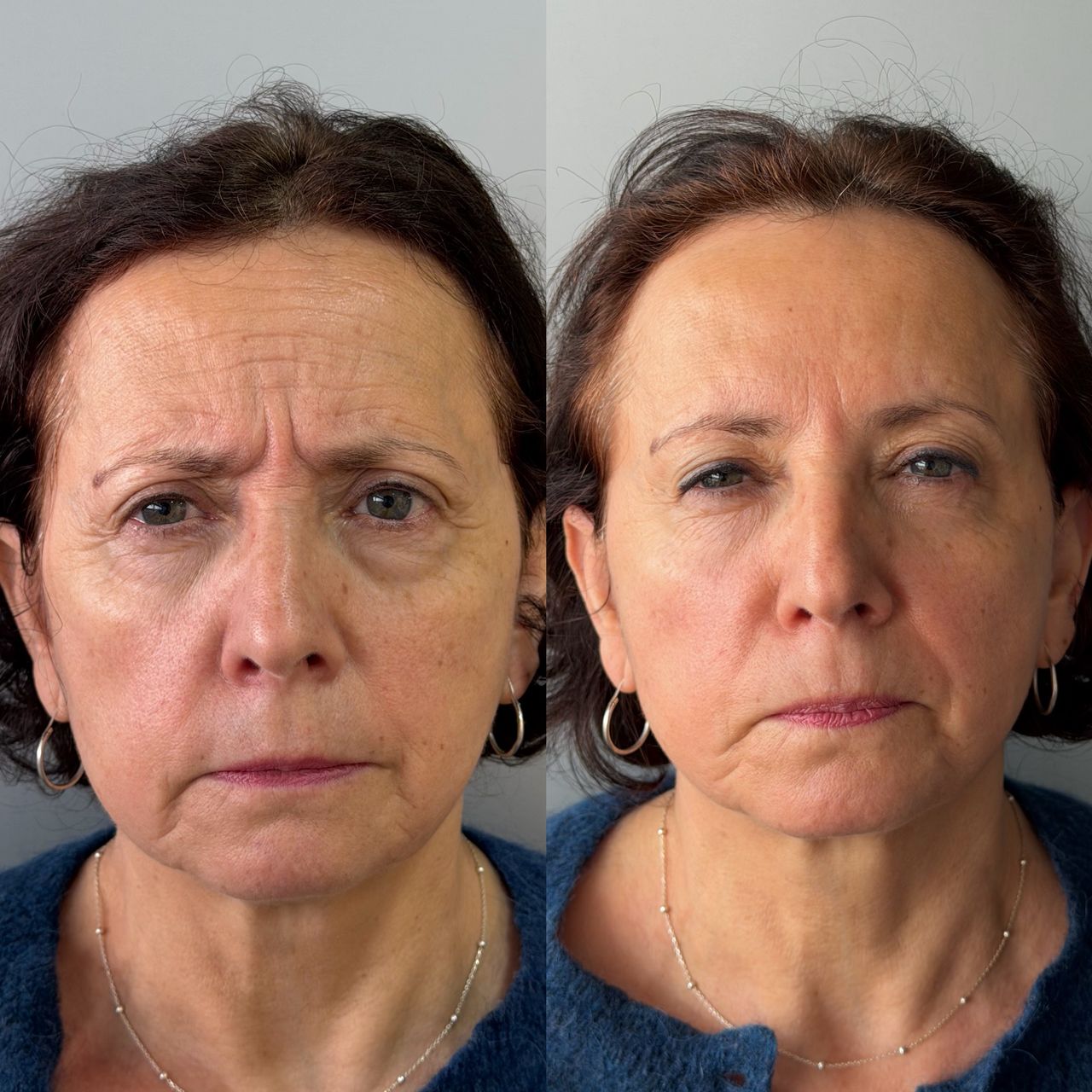 Susana Margarita Sierra Molina-23