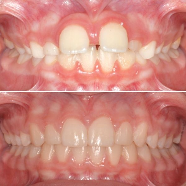 Frank Mendoza Alanya-30