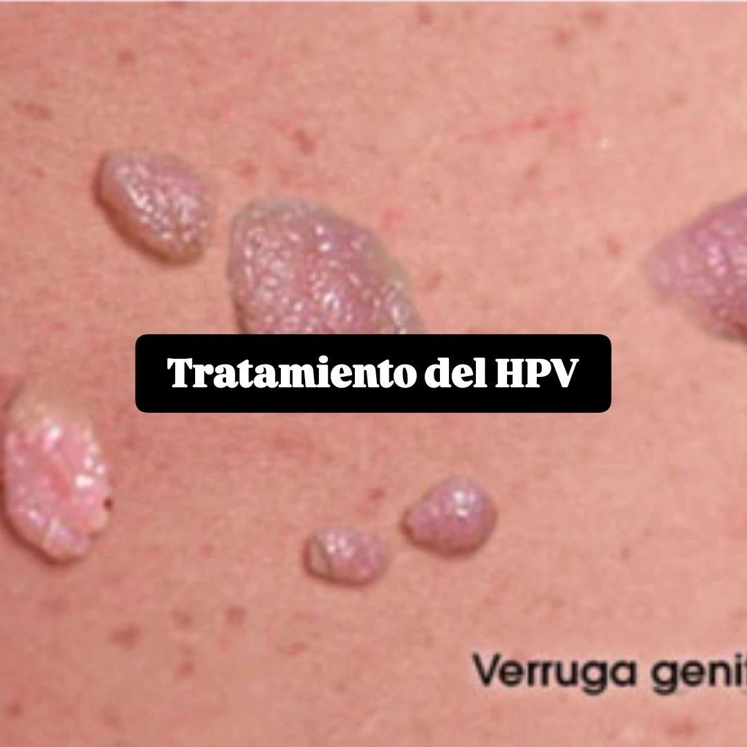 Marcelo Jose Ghione-6