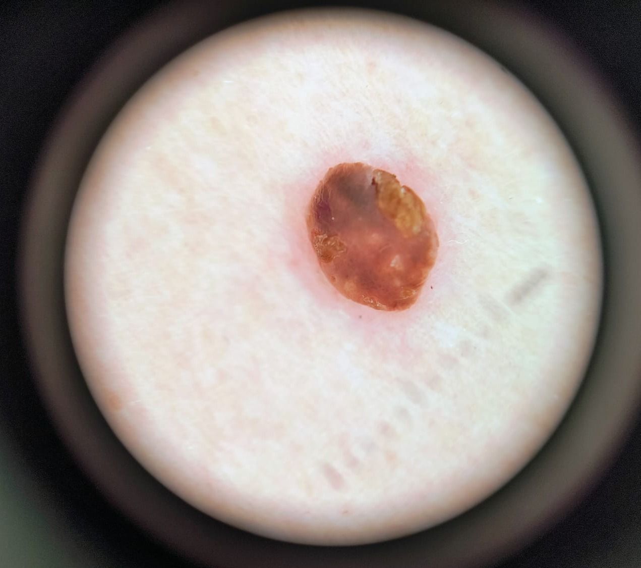 Marcos Ortiz Perez-14