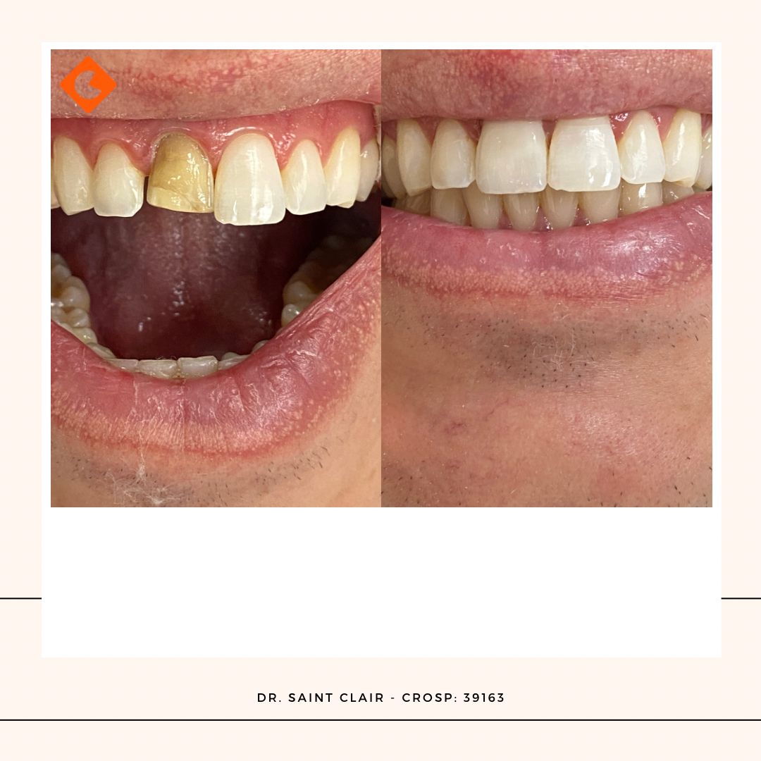 Saint Clair Barbosa Netto-6