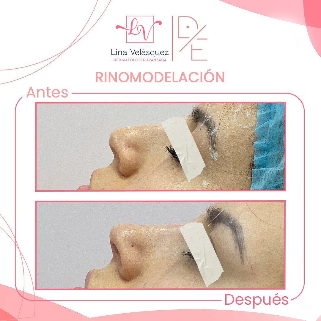 Lina Velásquez Tafur-12