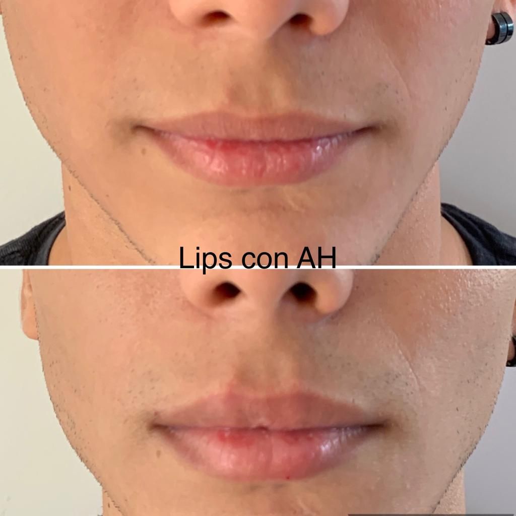 Maria Gisela Angel Losada-53