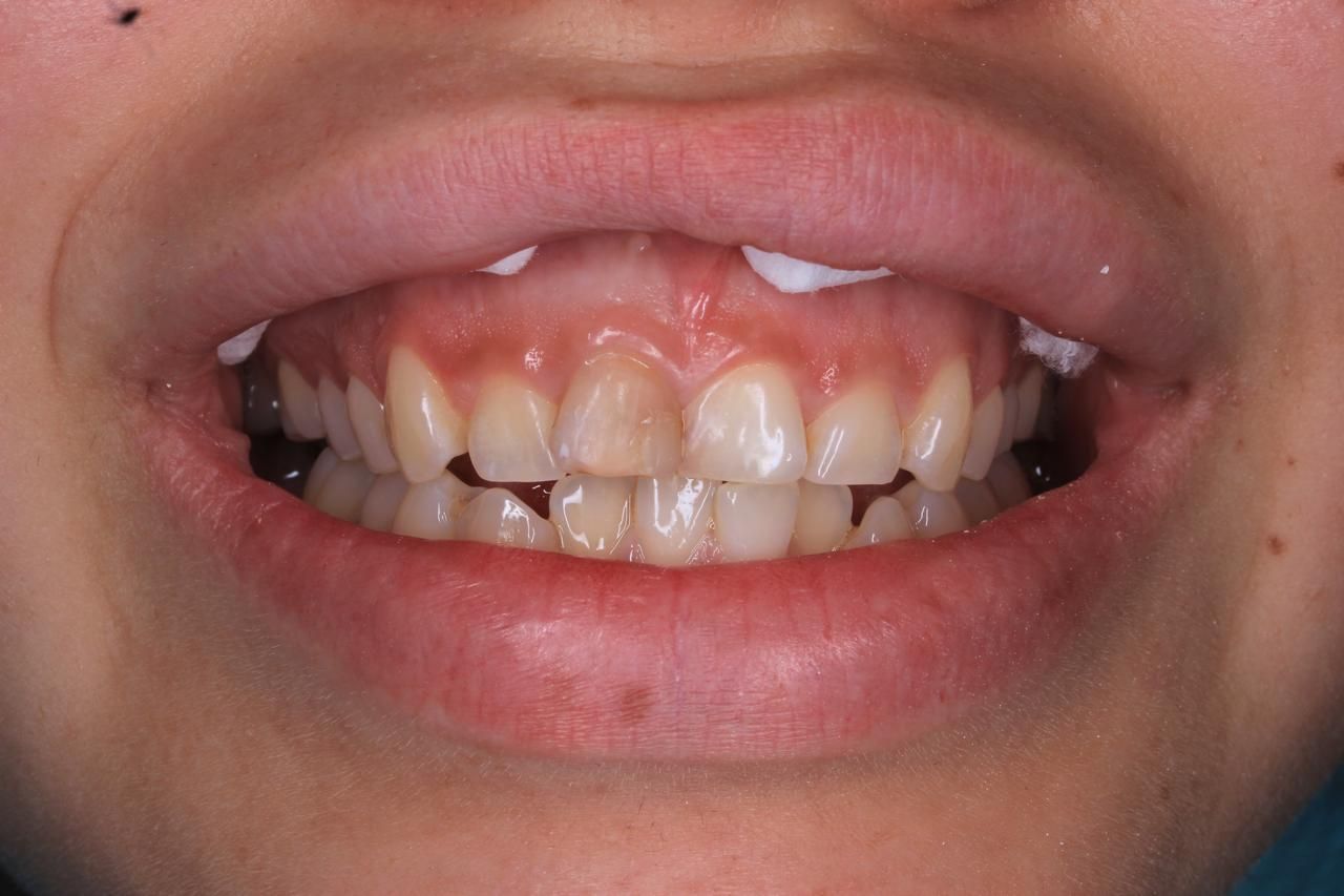 Francisco Bahamonde-8