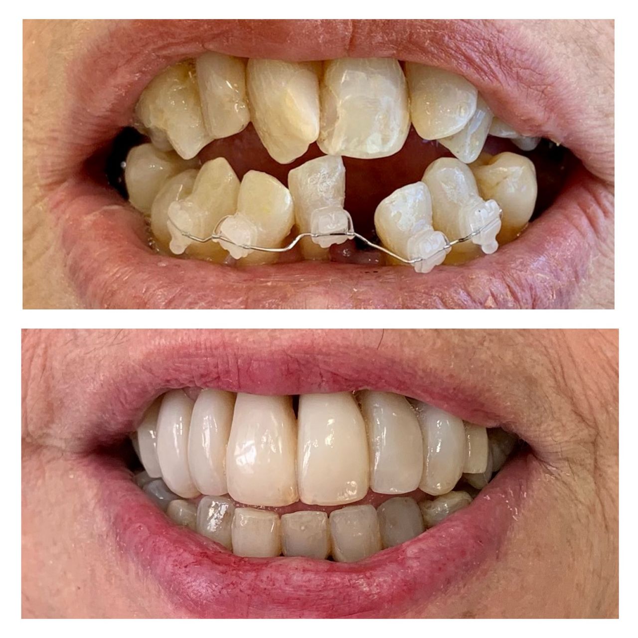 Adriana Souto Nôga .-6