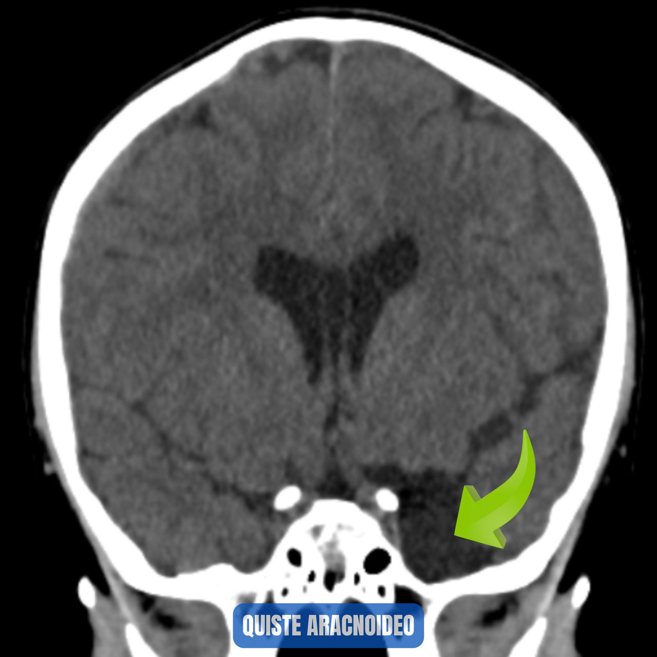 David Tafur Muñoz-1832