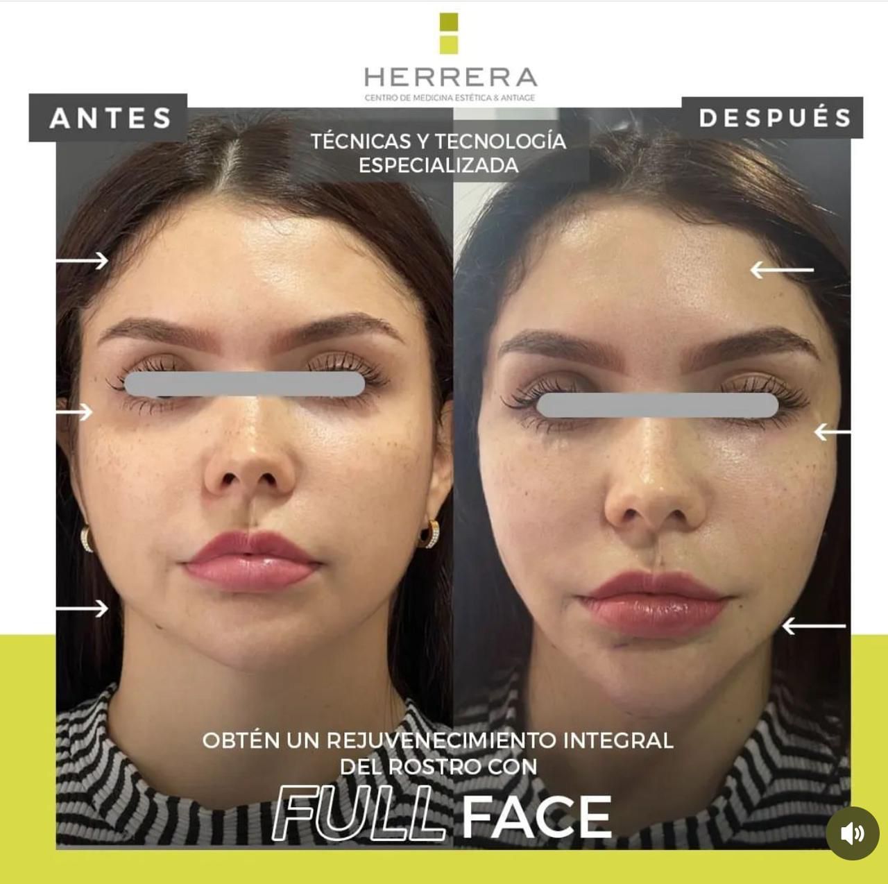 Andrea Alonso Herrera-14