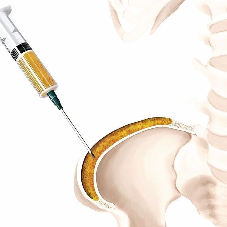 Victor Fontes Pacheco-24
