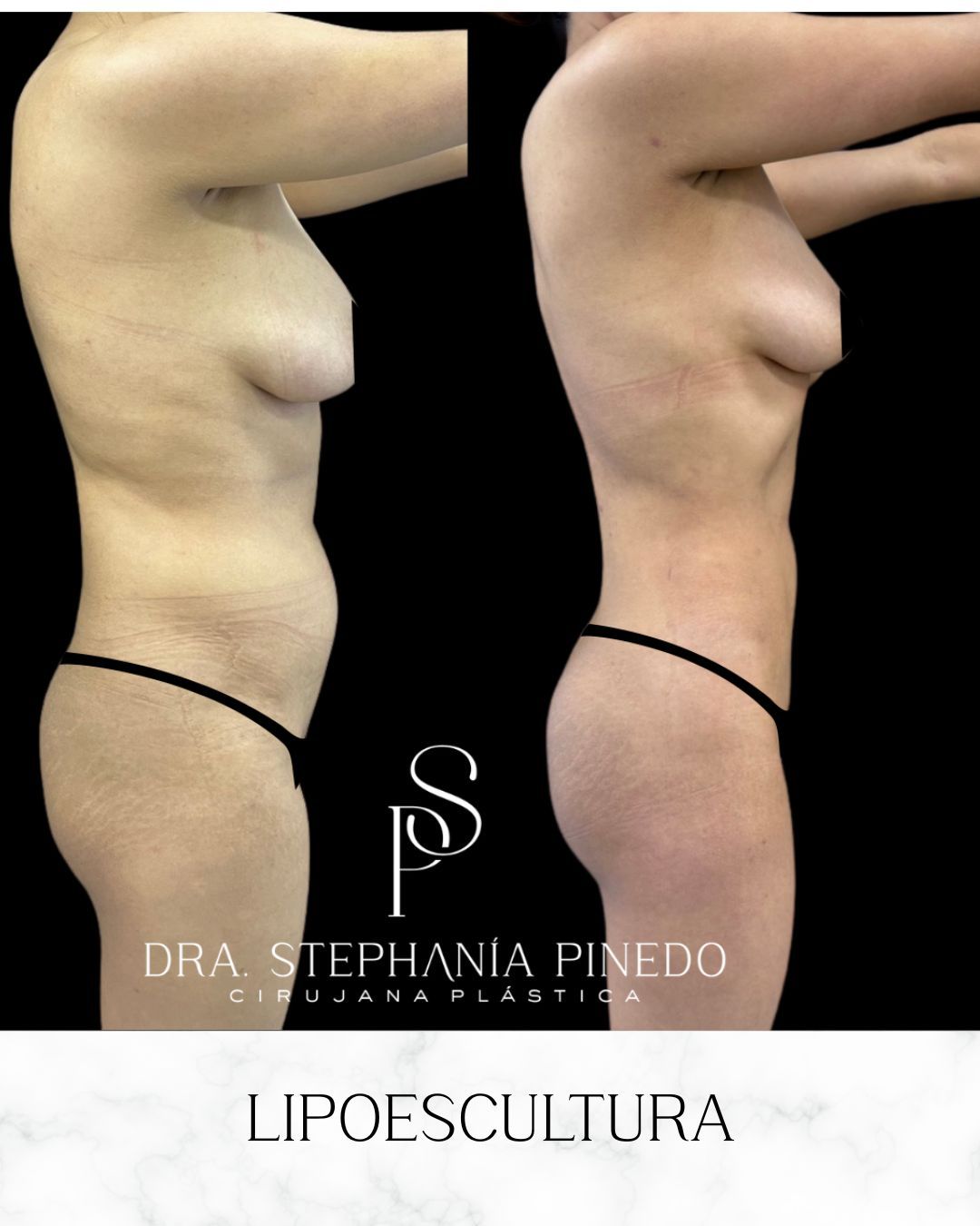 Stephanía Pinedo García-9