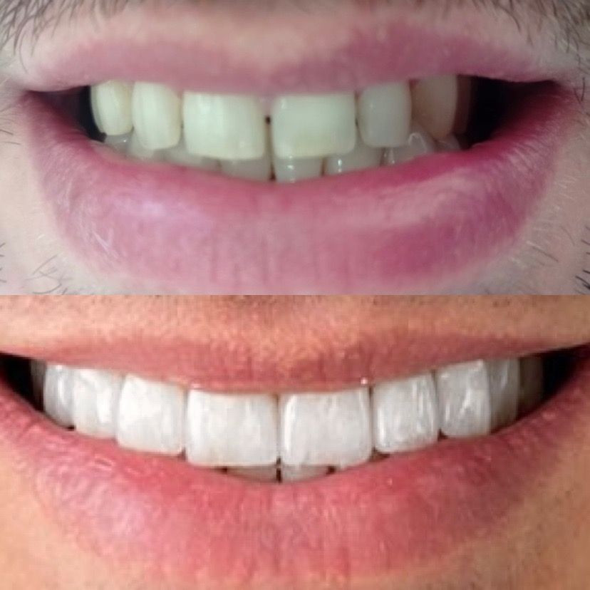 Rosemary Carneiro De Sá-44