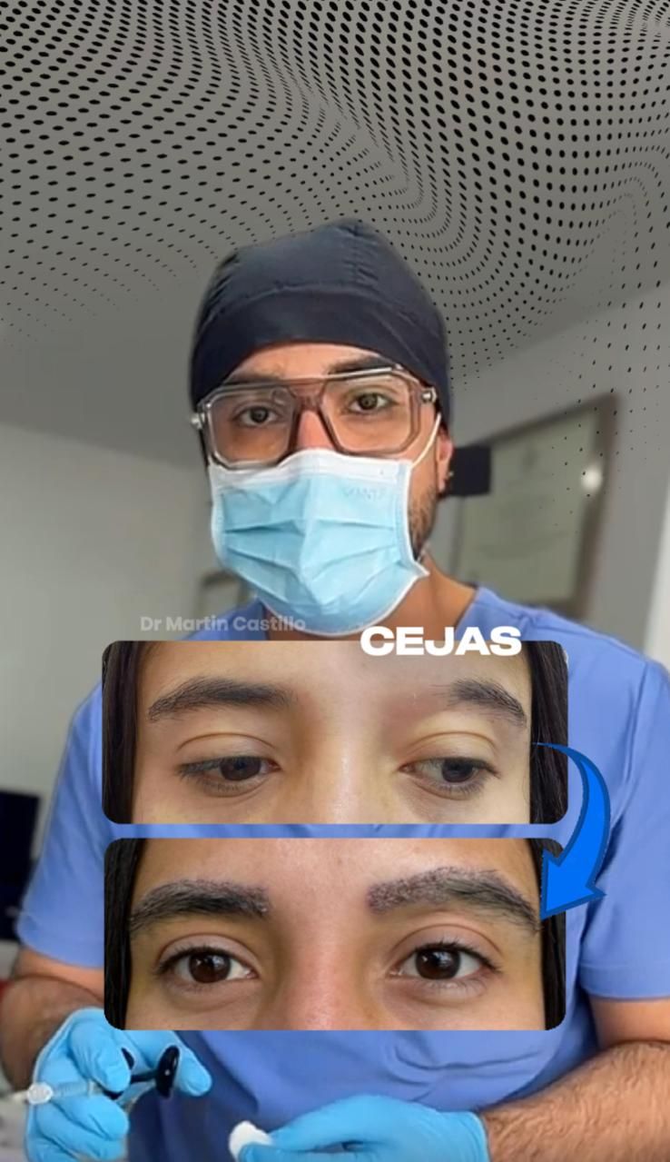 Martín Castillo Rueda-34