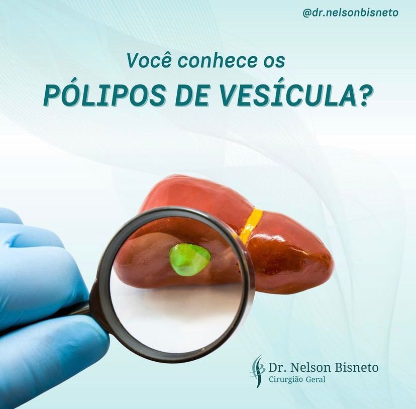Nelson Bisneto-70