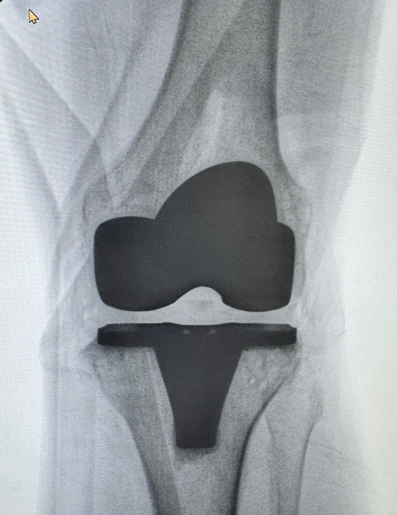 João Pedro Alves Ferreira-1