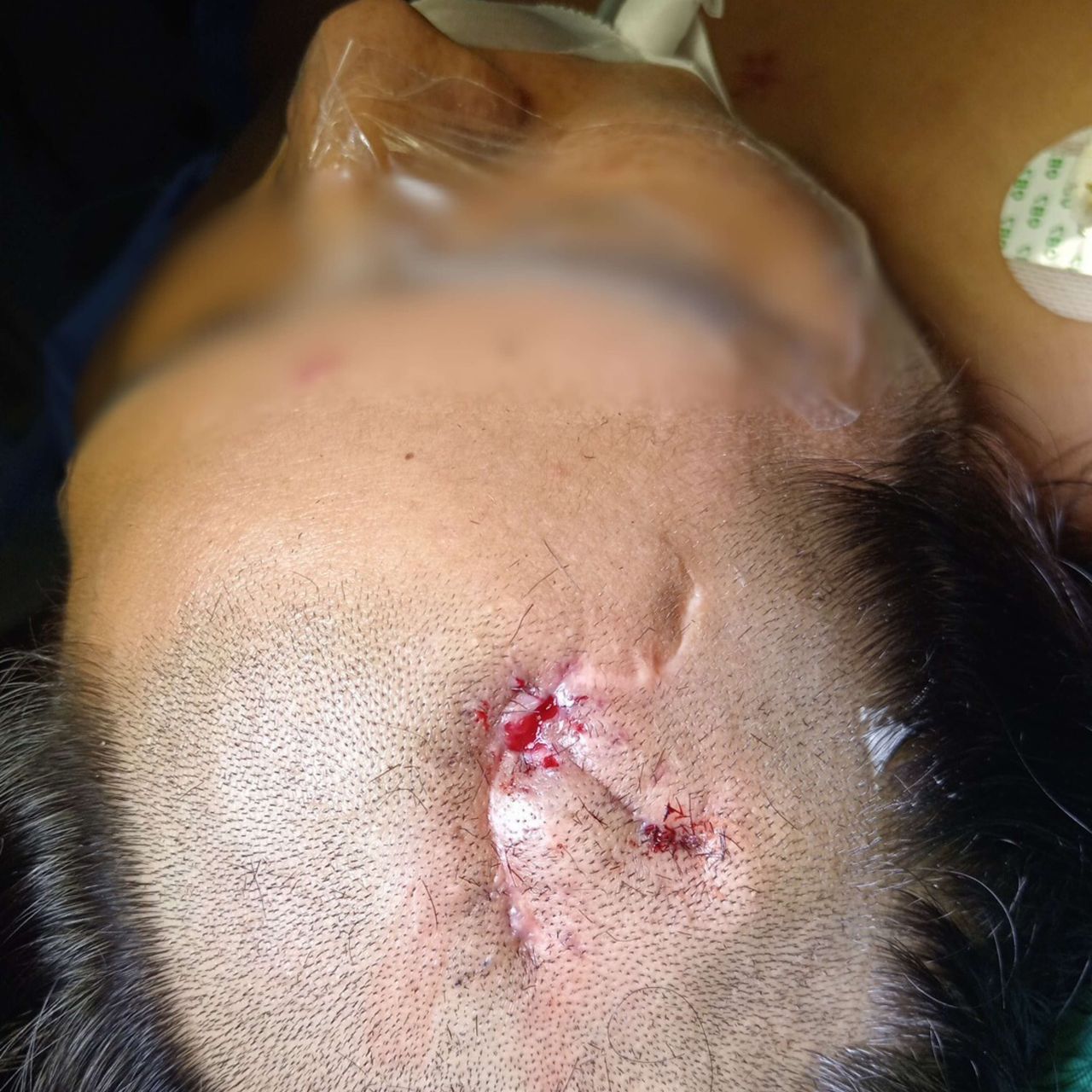 David Tafur Muñoz-2887
