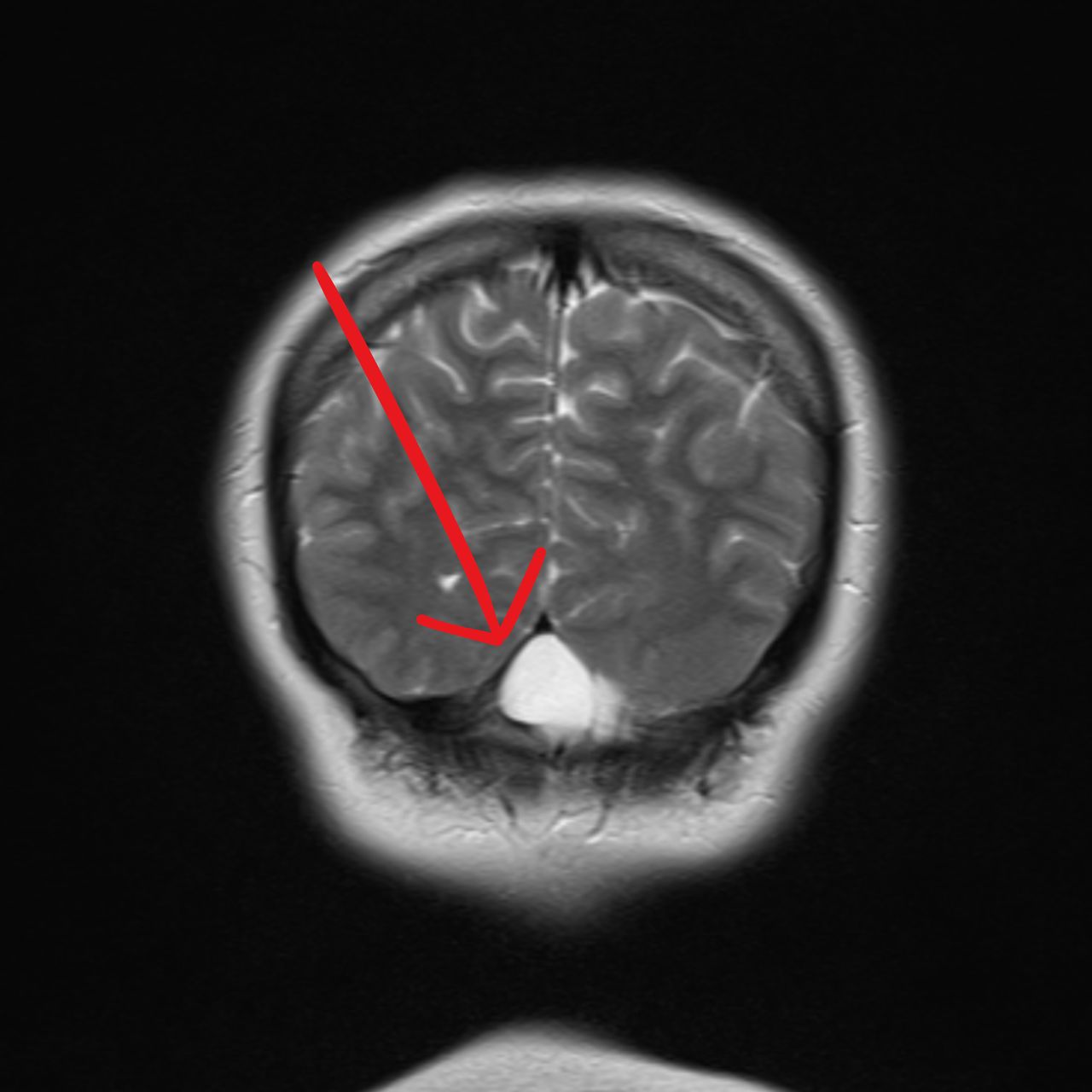 David Tafur Muñoz-2034